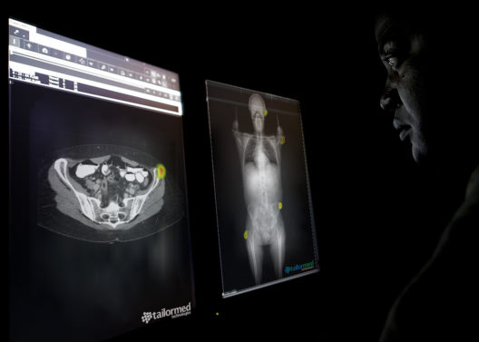 의료 이미지 진단 시장은 AI를 원한다