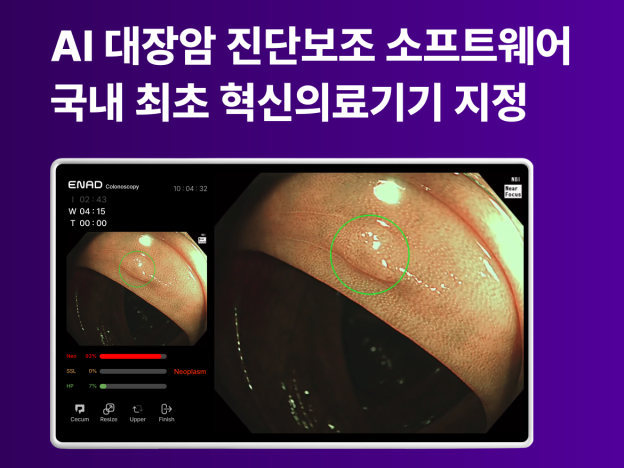 아이넥스 'AI 대장암 진단보조 소프트웨어', 혁신의료기기 지정 - 뉴스 썸네일 이미지